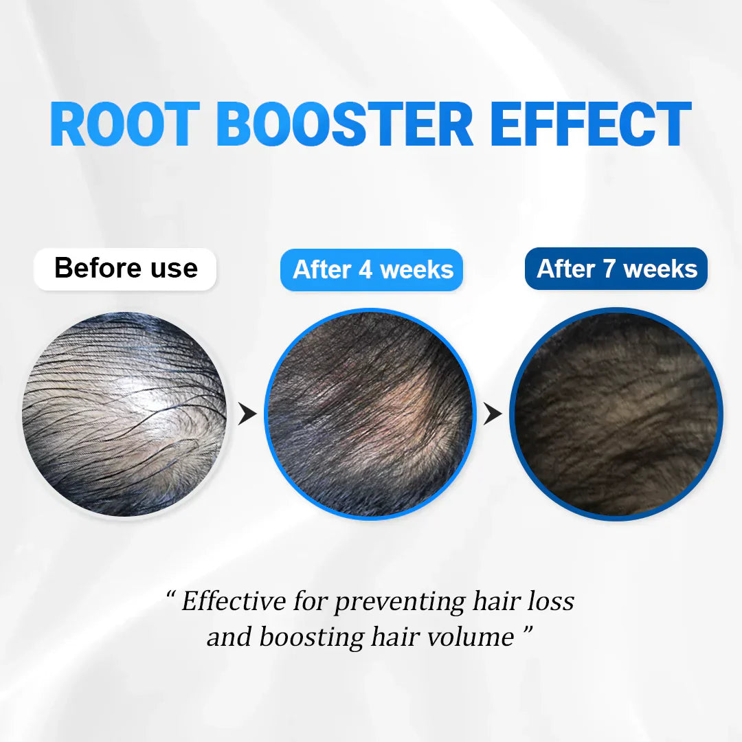 FolicleRevive™ - Korean Hair Growth Breakthrough That Regrows Lost Hair in Just 3 Weeks (+ FREE Annual Planner | 50 pages)