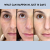 YouthLift™ Renew Strips – The Instant Solution for Timeless Beauty (1+1 FREE)