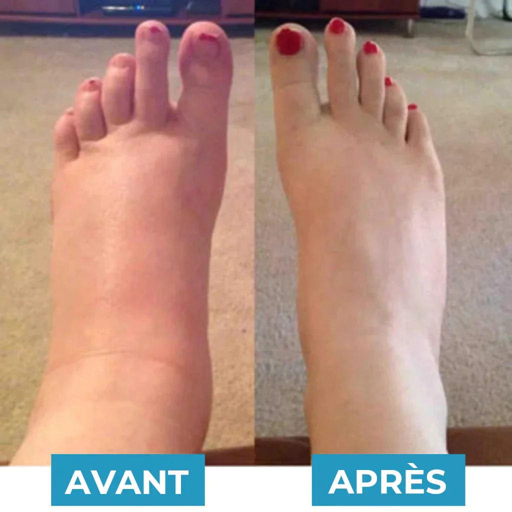 CircuFlow™ - Revitalise Tired, Aching Feet in Just 15 Minutes (+ FREE Mystery Gift)