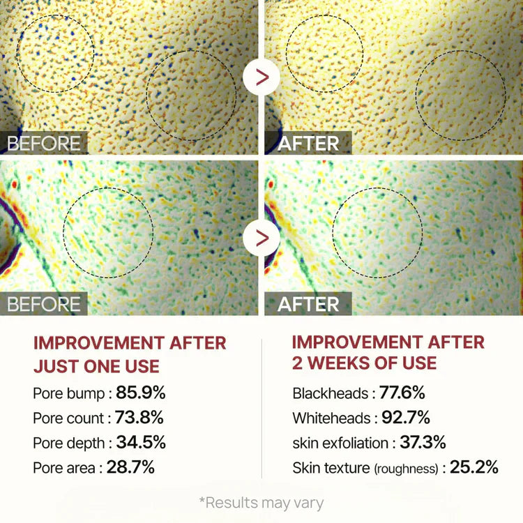 PureRice™ – Exfoliating Rice Peel for Silky Smooth, Bright Skin (+ FREE Annual Planner | 50 pages)