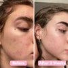 GlowReveal™ - Erase Dark Spots In 14 Days Or Less (40 Pads)