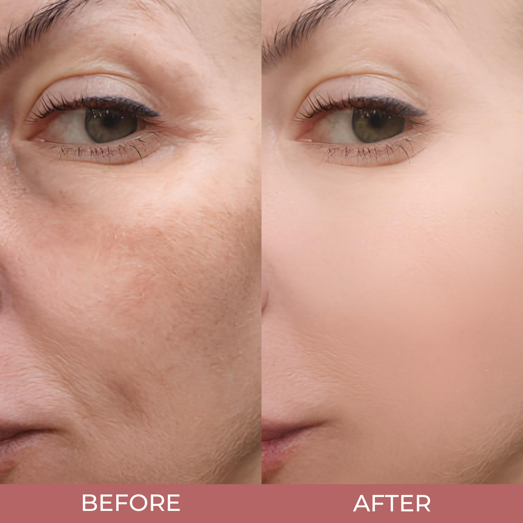 GlowRevive™ - Erase Years of Sun Damage Naturally (+ FREE Mystery bonus)