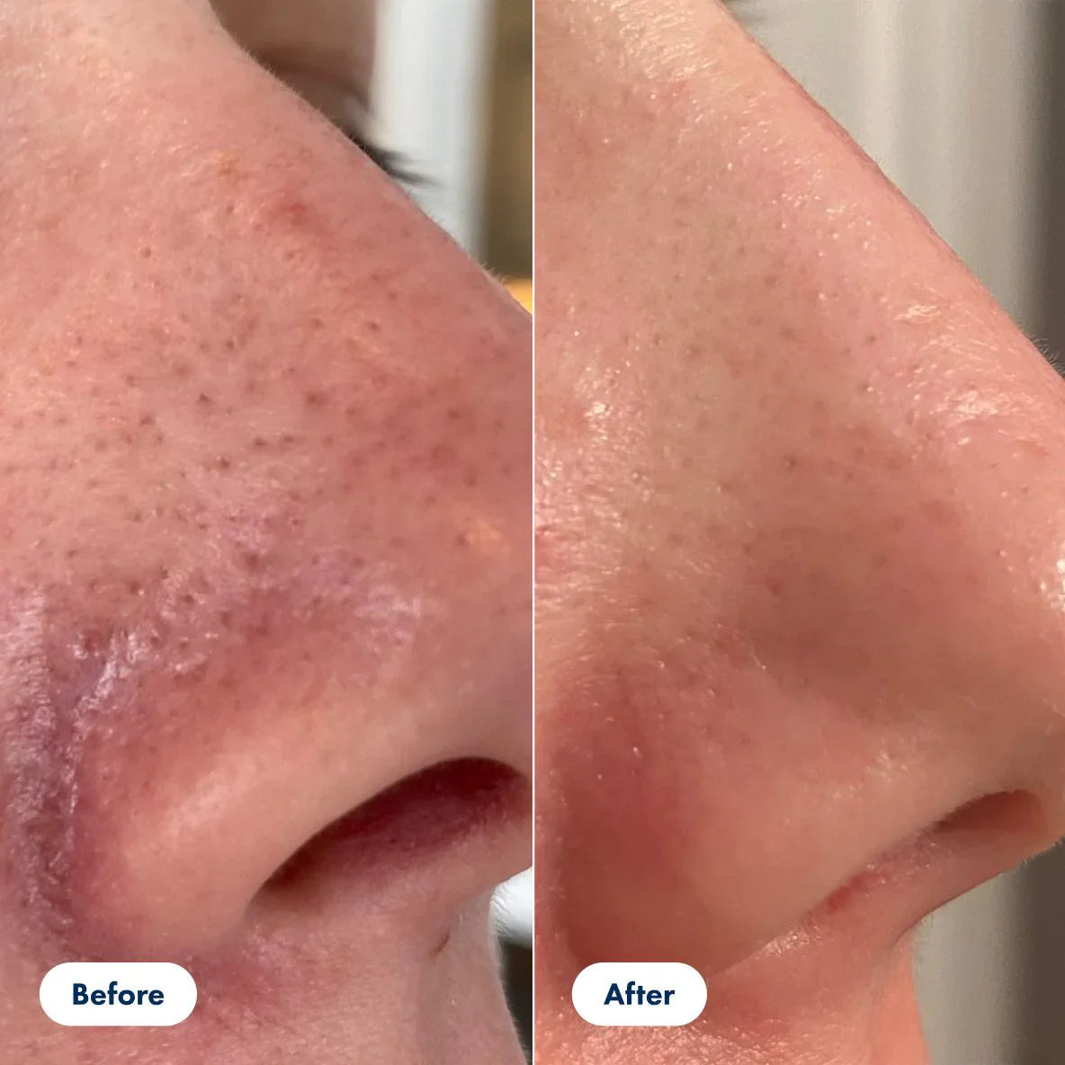 GlassSkin Pro™ - Get Poreless, Radiant Skin Overnight (+ FREE Mystery bonus)