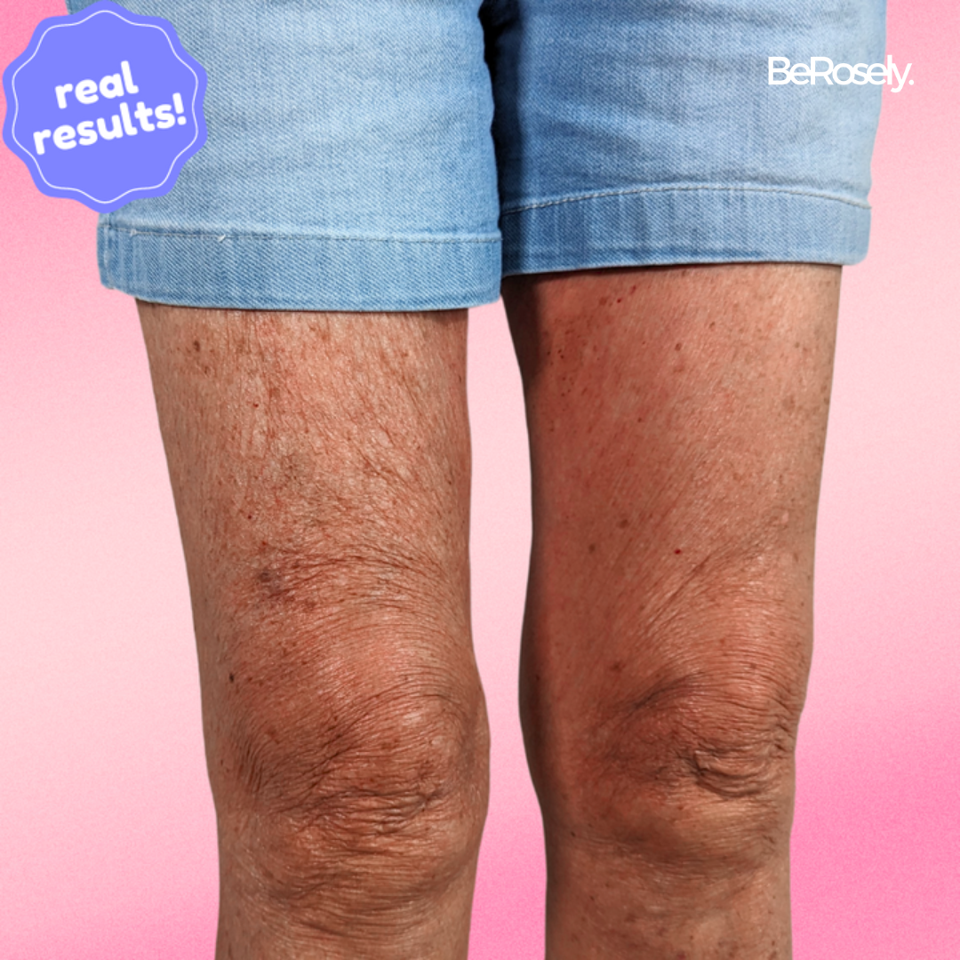 SkinBlend™ - Your Secret to Flawless, Confident Skin in Minutes (10+5 FREE | 20+10 FREE)