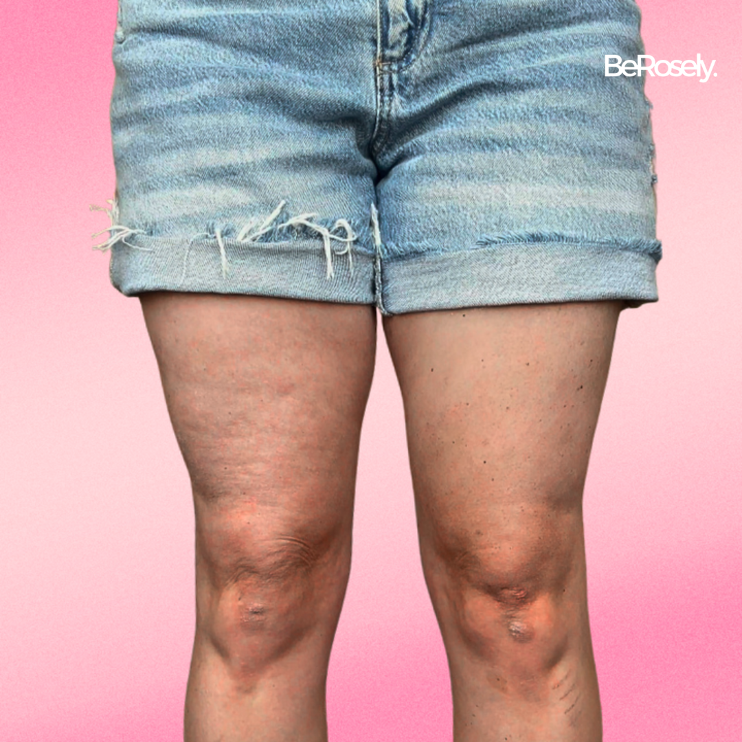 SkinBlend™ - Your Secret to Flawless, Confident Skin in Minutes (10+5 FREE | 20+10 FREE)