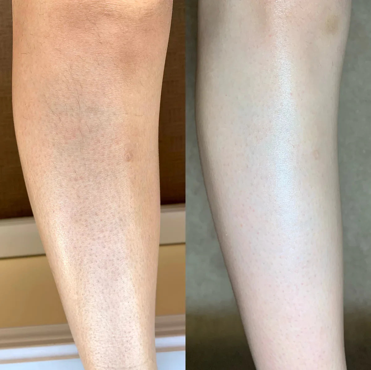 DermaScrub™ -  Removes Dead Skin & Boosts Circulation (+2 sponges & e-book for FREE)