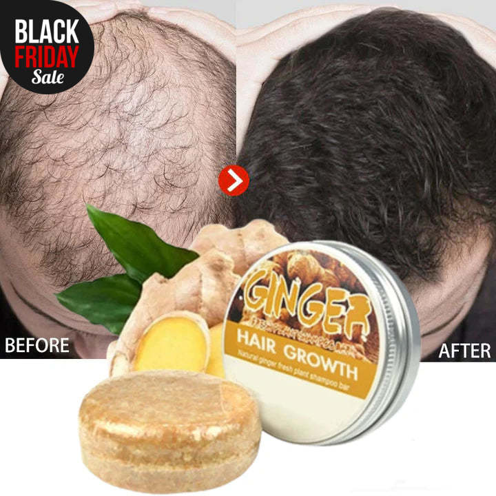 ReGrow™ - Shampoo Against Hair Loss