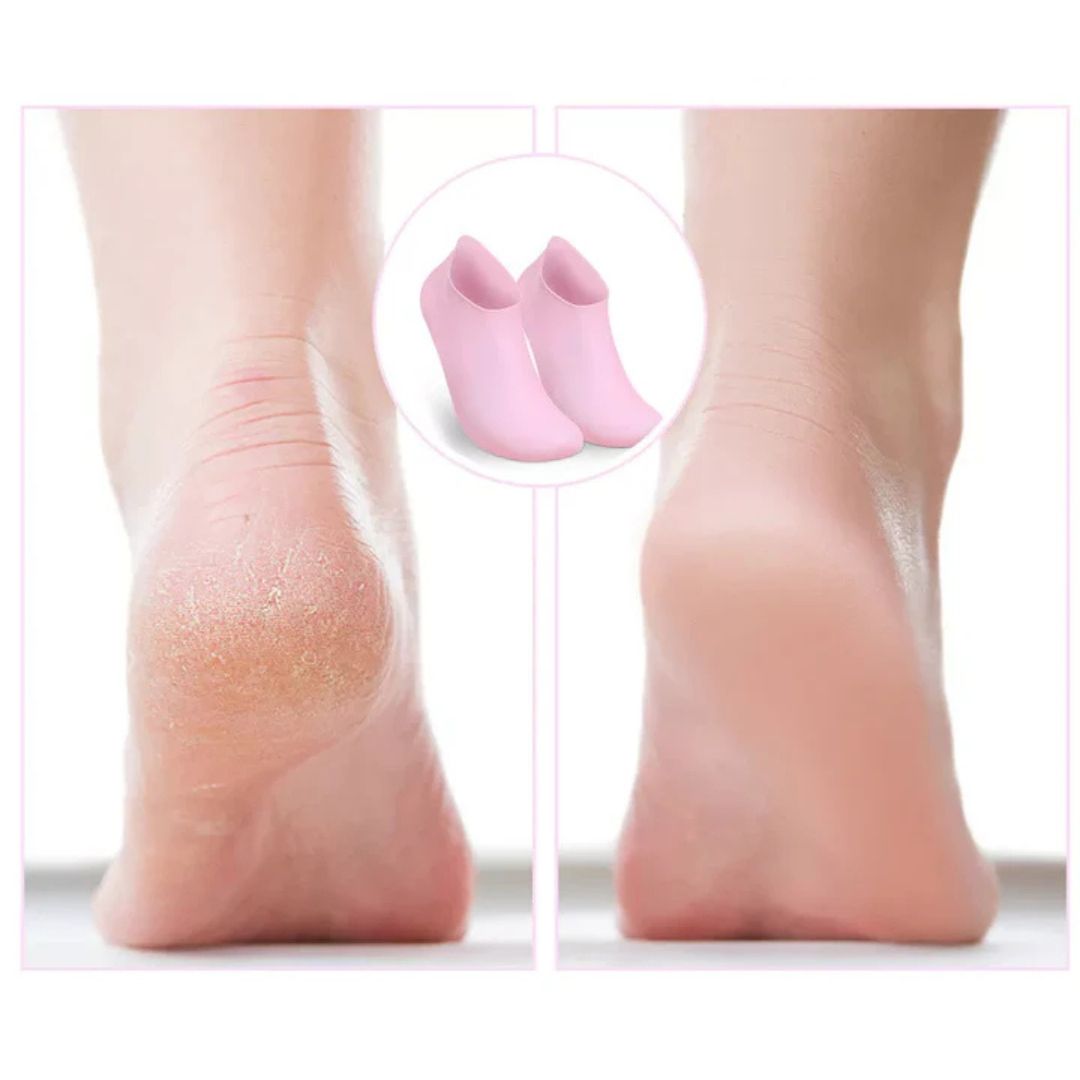 SoftFeet Pro™ - Transform Cracked Heels Into Baby-Soft Skin Overnight (+ FREE Mystery bonus)