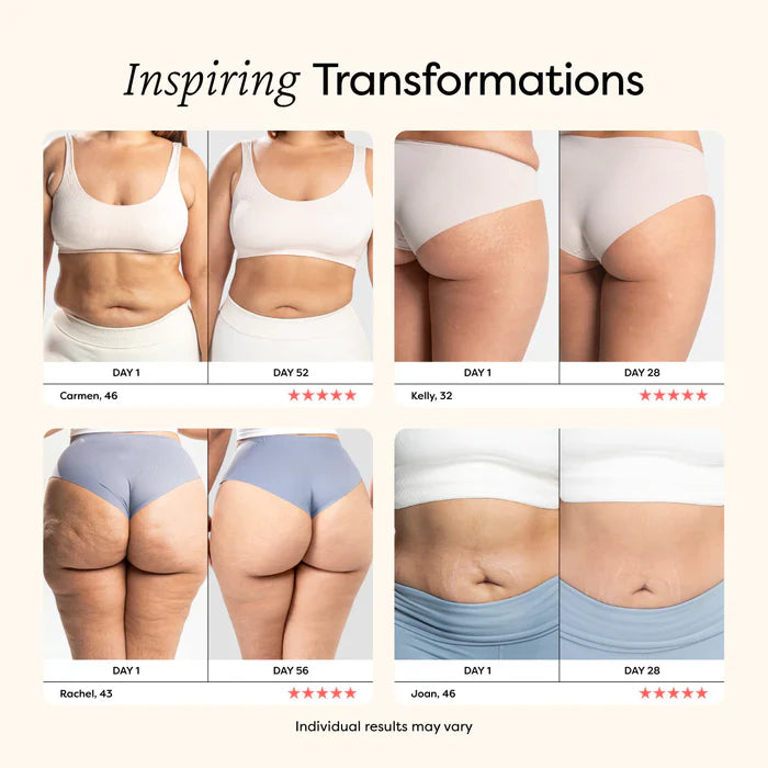 SmoothRoll Elite™ - Erase Cellulite, Reveal Smooth Skin (+ FREE Mystery bonus)