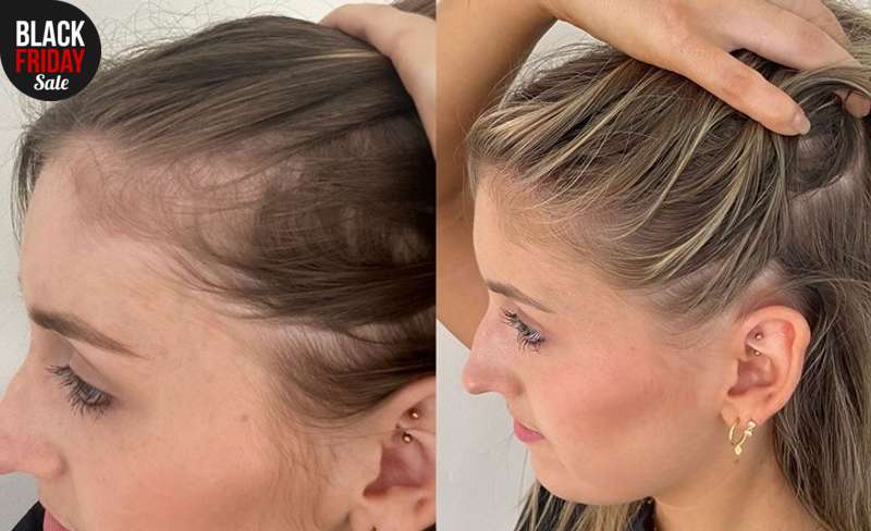 ReGrow™ - Shampoo Against Hair Loss