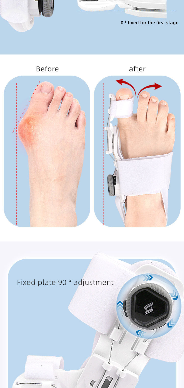 ToeAlign Pro™ - Straighten Bunions Without Surgery (+ FREE Mystery bonus)