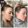 ReGrow™ - Shampoo Against Hair Loss