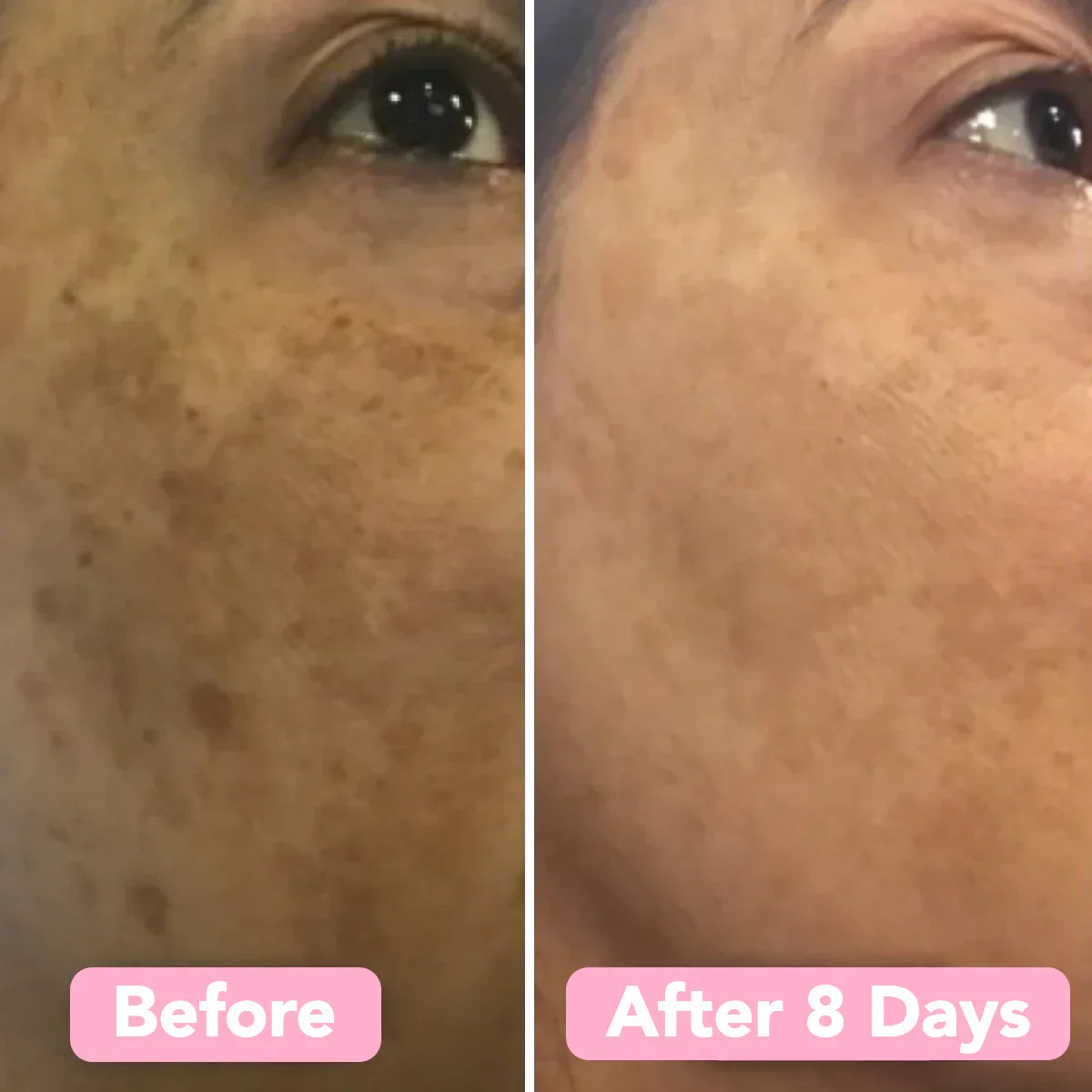 GlowReveal™ - Erase Dark Spots In 14 Days Or Less (40 Pads)