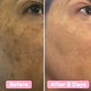 GlowReveal™ - Erase Dark Spots In 14 Days Or Less (40 Pads)