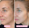 GlowReveal™ - Erase Dark Spots In 14 Days Or Less (40 Pads)