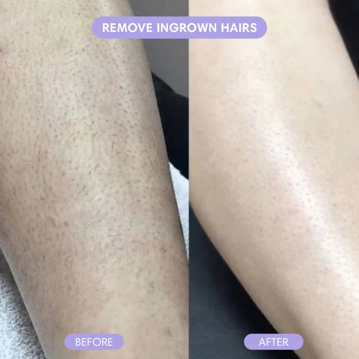 SilkTrim Pro™ - Get Salon-Smooth Legs in 60 Seconds (+ FREE Mystery bonus)