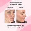 GlowReveal™ - Erase Dark Spots In 14 Days Or Less (40 Pads)