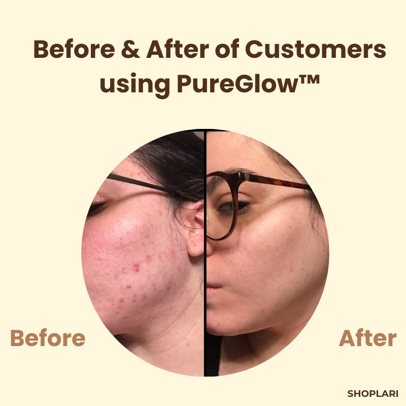 PureGlow™ - Erase Years of Skin Damage in Just 15 Minutes (+ FREE Mystery bonus)