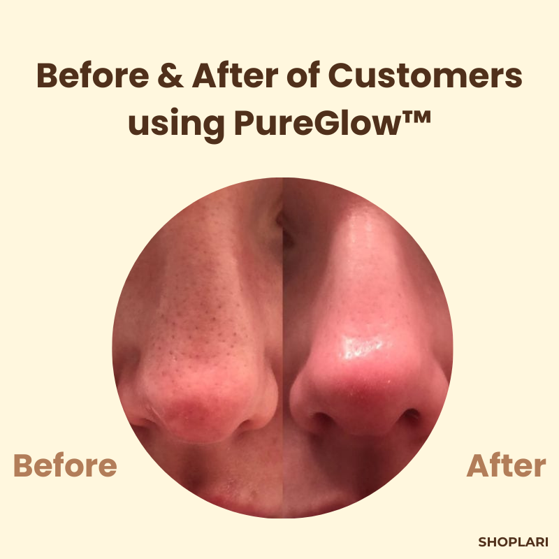 PureGlow™ - Erase Years of Skin Damage in Just 15 Minutes (+ FREE Mystery bonus)