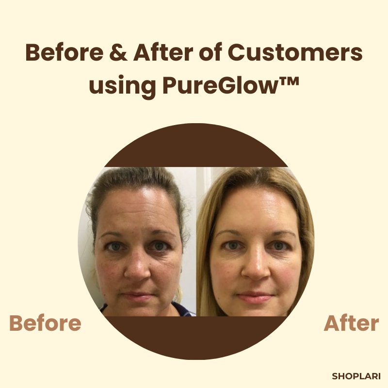 PureGlow™ - Erase Years of Skin Damage in Just 15 Minutes (+ FREE Mystery bonus)