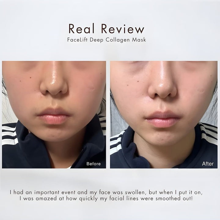 LiftLux™ - Turn Back Time in Just 30 Minutes