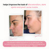 GlowReveal™ - Erase Dark Spots In 14 Days Or Less (40 Pads)