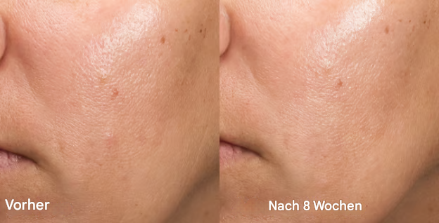 RefreshGlow Pro™ - Reveal Baby-Soft Skin in Just 60 Seconds (+ FREE Mystery bonus)